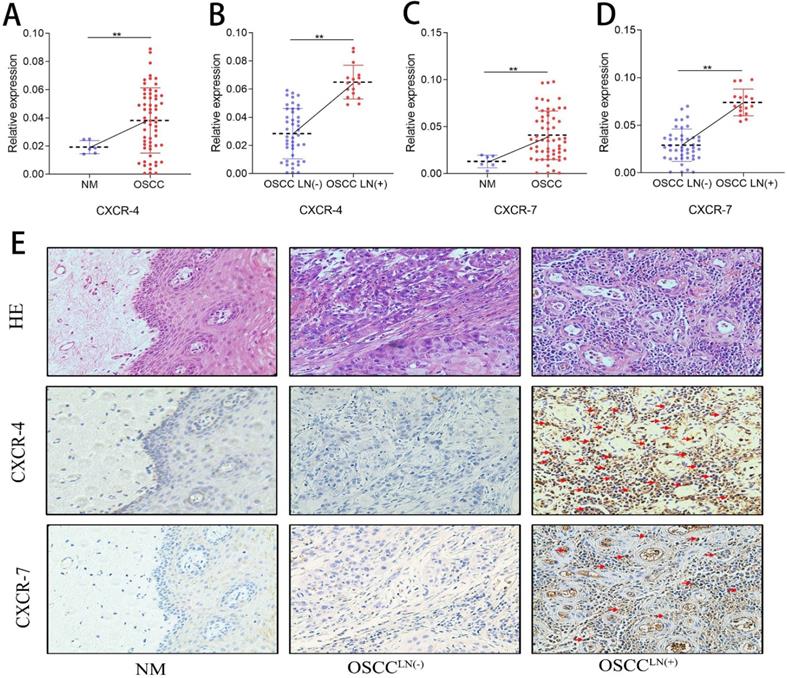 Increased tumor-infiltrating plasmacytoid dendritic cells promote ...