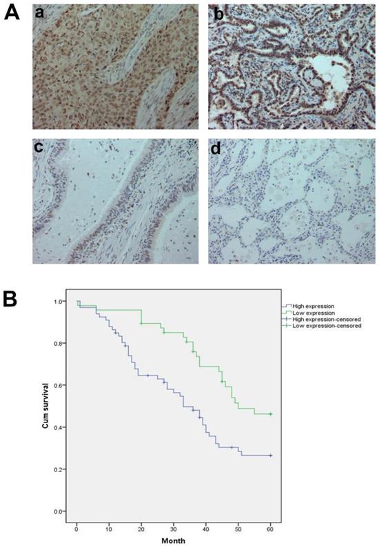 J Cancer Image