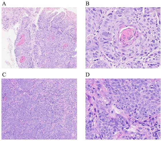 Patterns and Prognosis of Local Recurrence of Nasopharyngeal Carcinoma ...