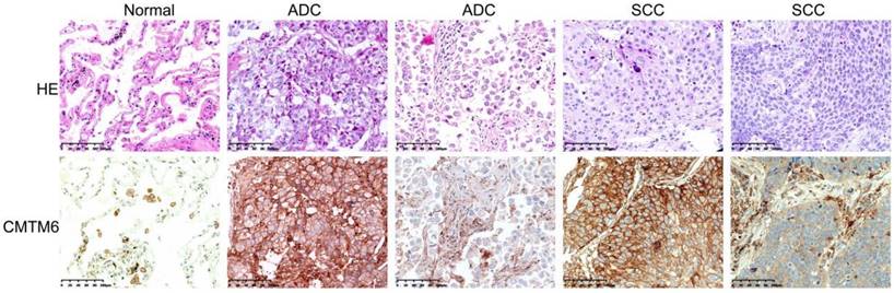 J Cancer Image