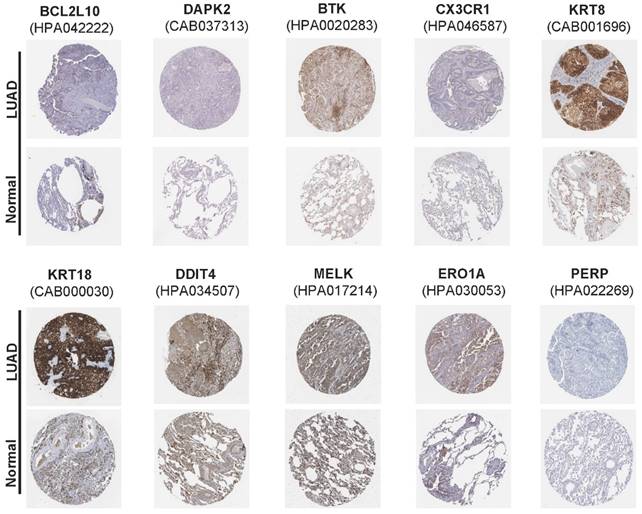 J Cancer Image
