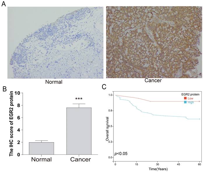 J Cancer Image