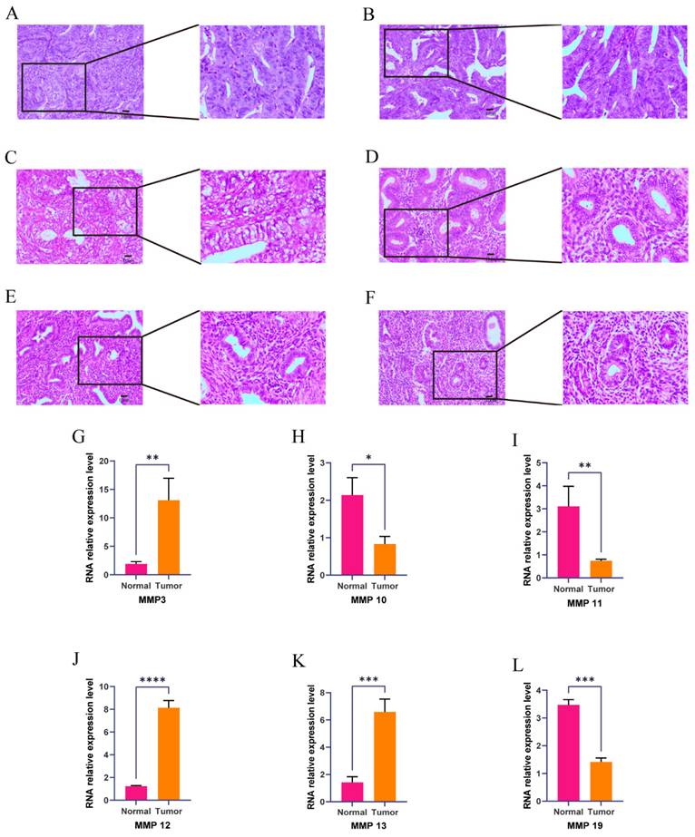 J Cancer Image