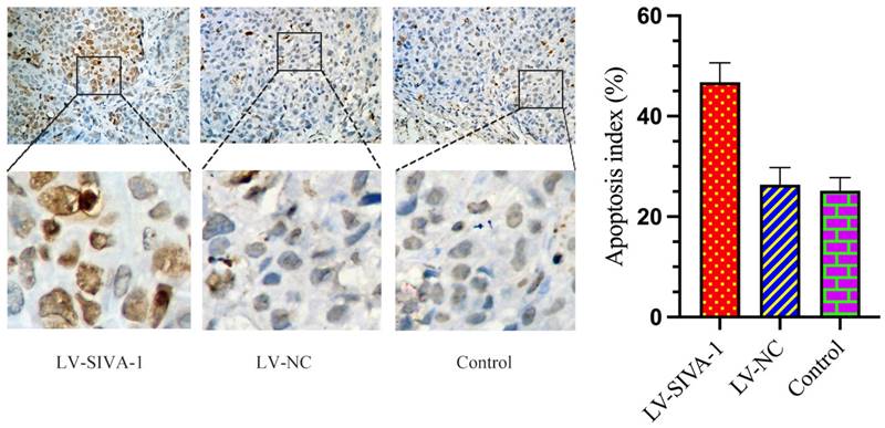 J Cancer Image
