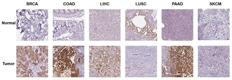 J Cancer Image
