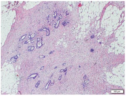 J Cancer Image