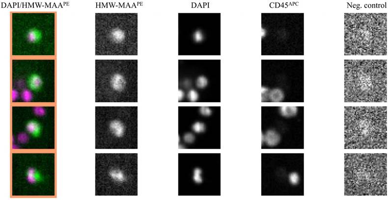 J Cancer Image