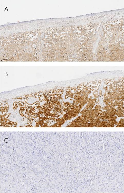 J Cancer Image