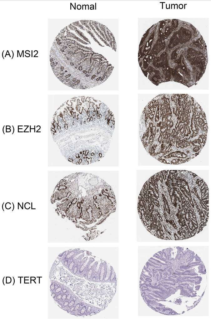 J Cancer Image
