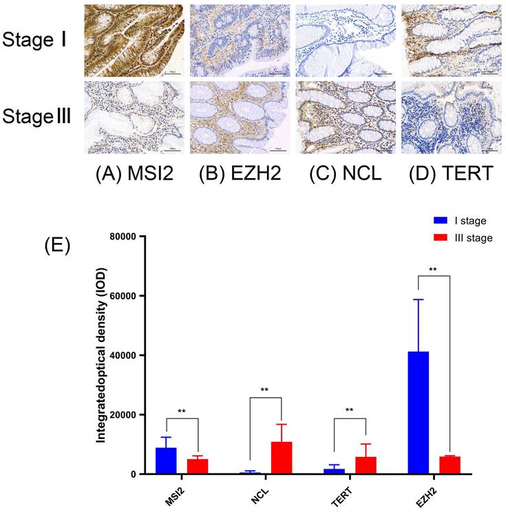 J Cancer Image
