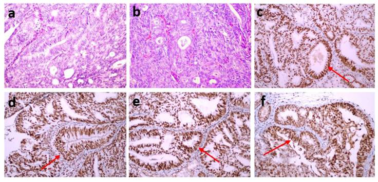 J Cancer Image