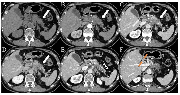 J Cancer Image