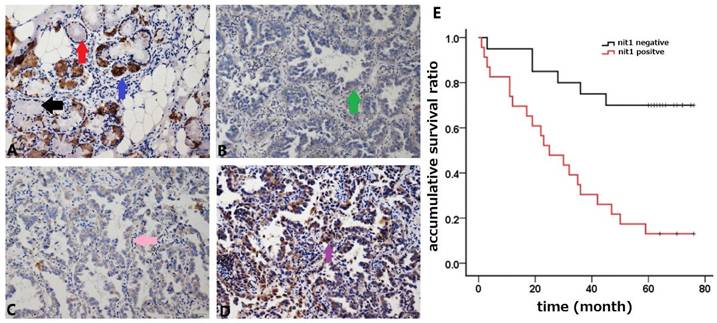 J Cancer Image