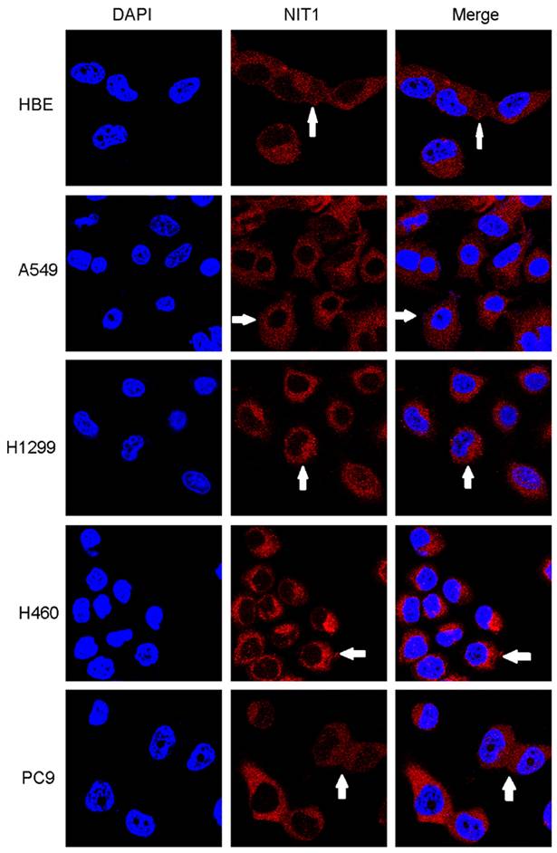 J Cancer Image