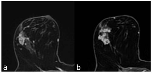 J Cancer Image
