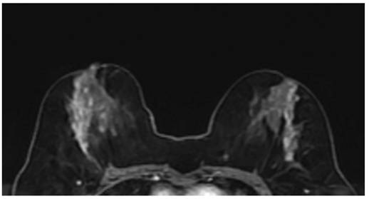 J Cancer Image