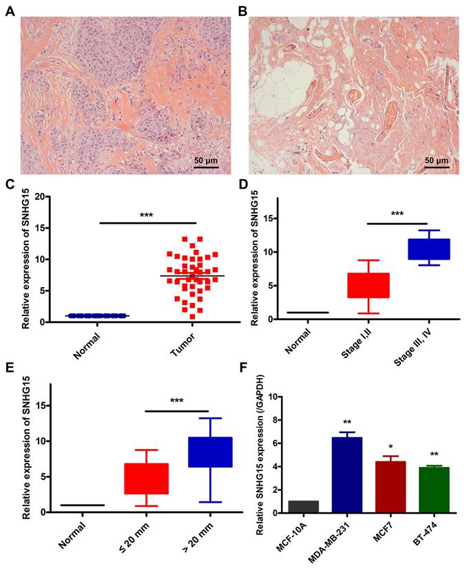 J Cancer Image