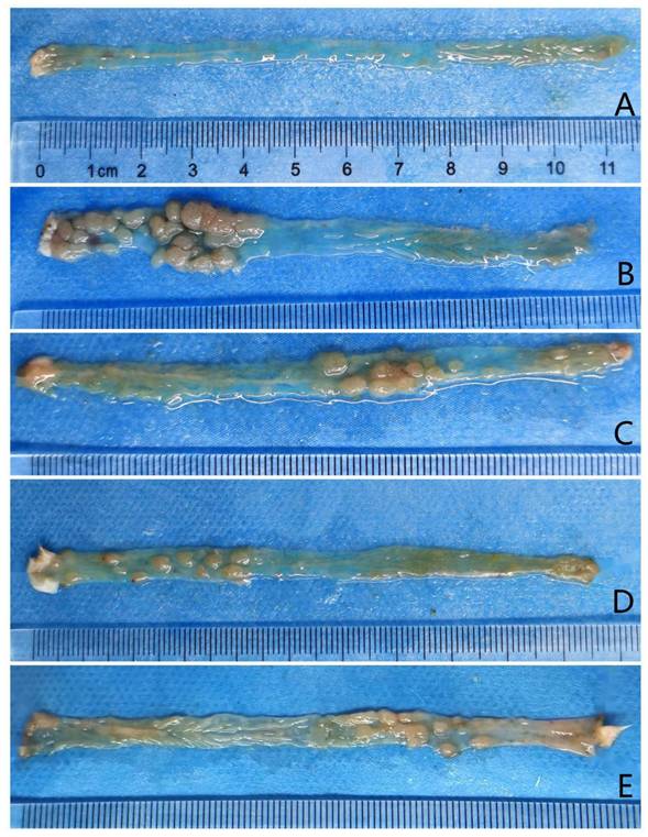 J Cancer Image