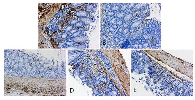 J Cancer Image