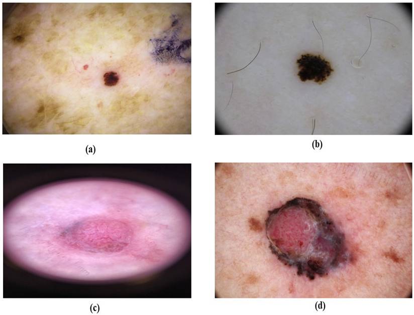 J Cancer Image