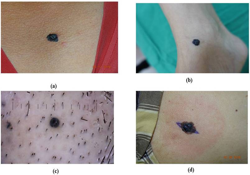 J Cancer Image