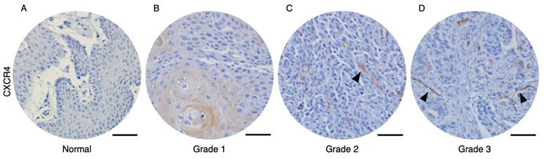 J Cancer Image