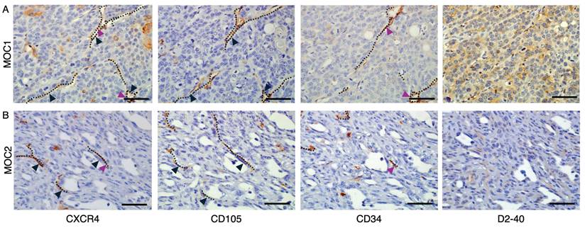 J Cancer Image