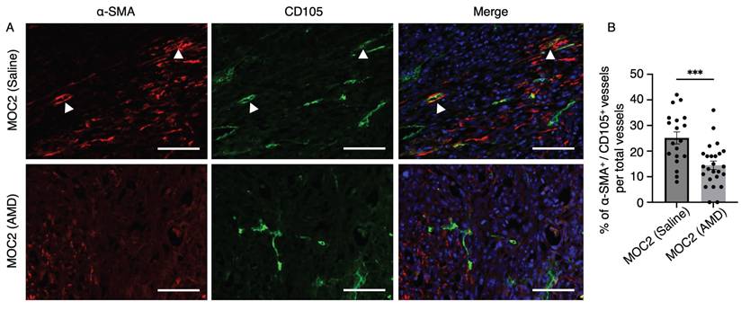 J Cancer Image