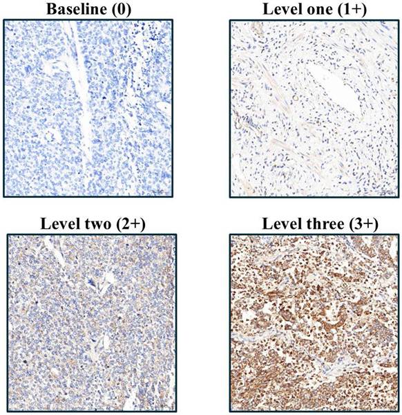 J Cancer Image