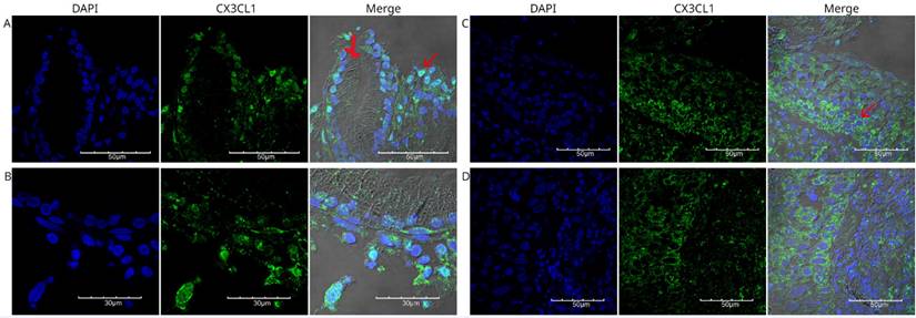 J Cancer Image
