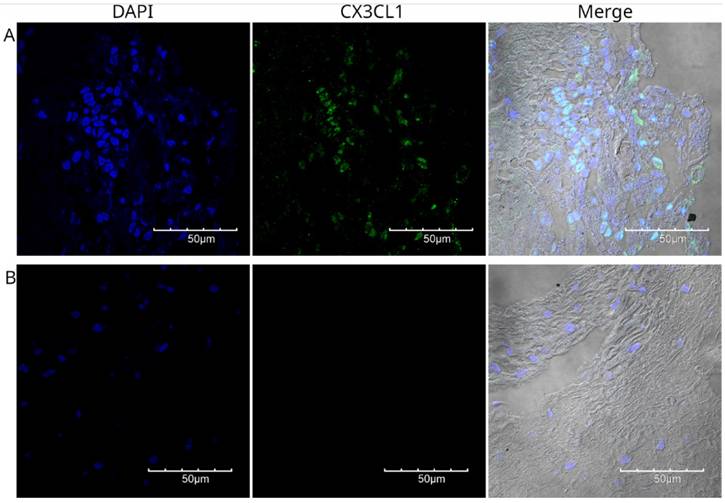 J Cancer Image