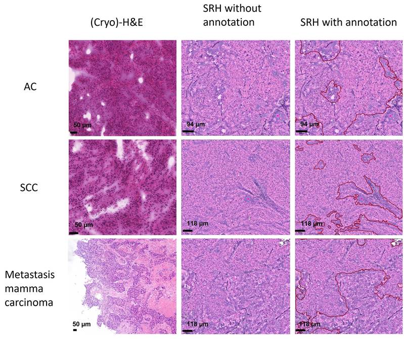 J Cancer Image