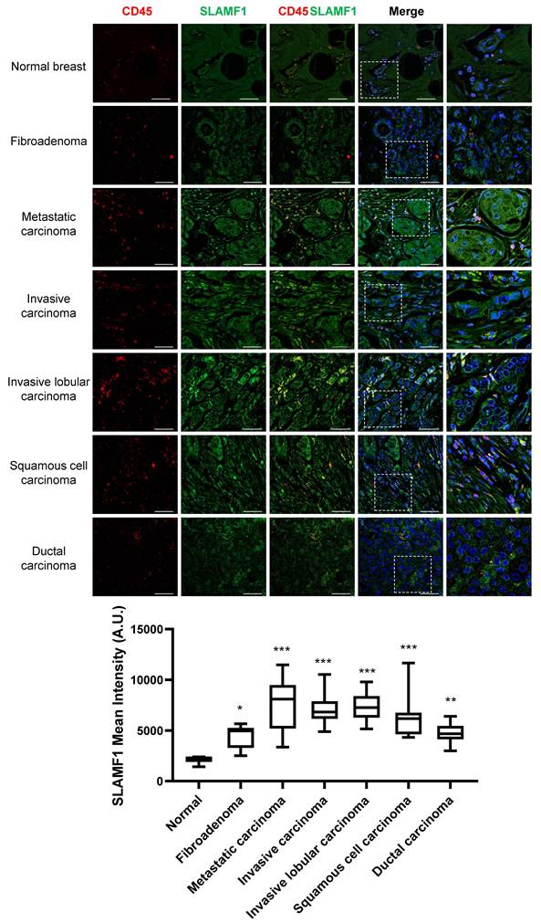 J Cancer Image